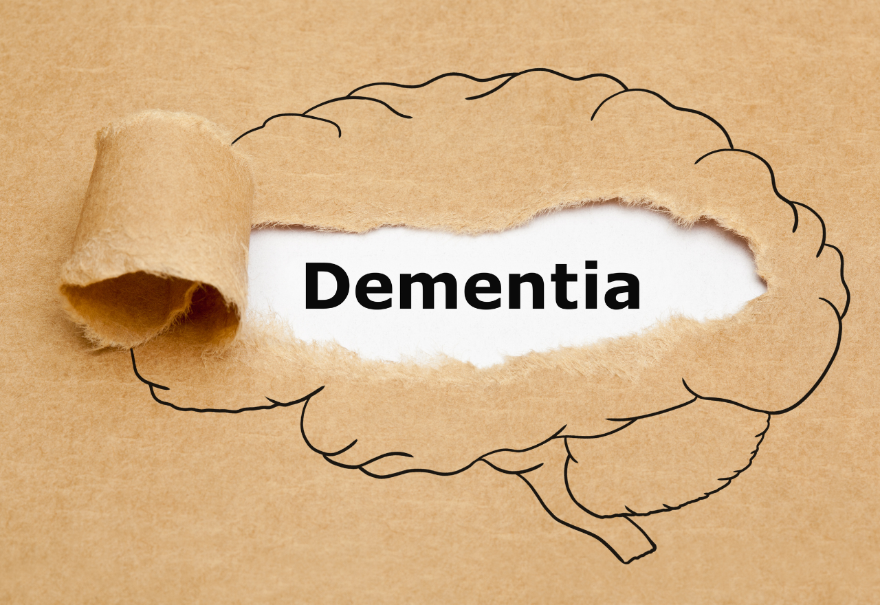 Dementia now leading cause of death for Australians